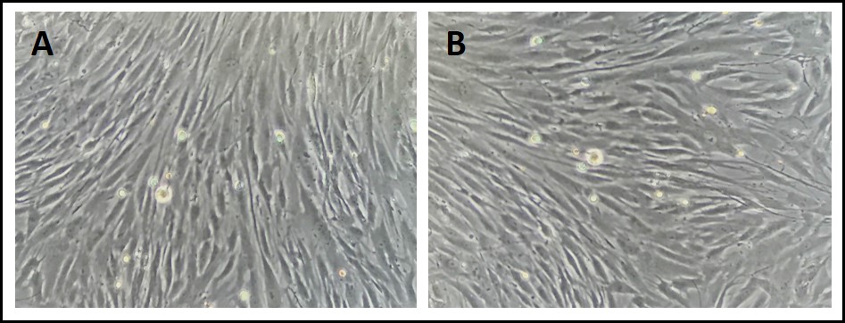 Human Dermal Fibroblasts