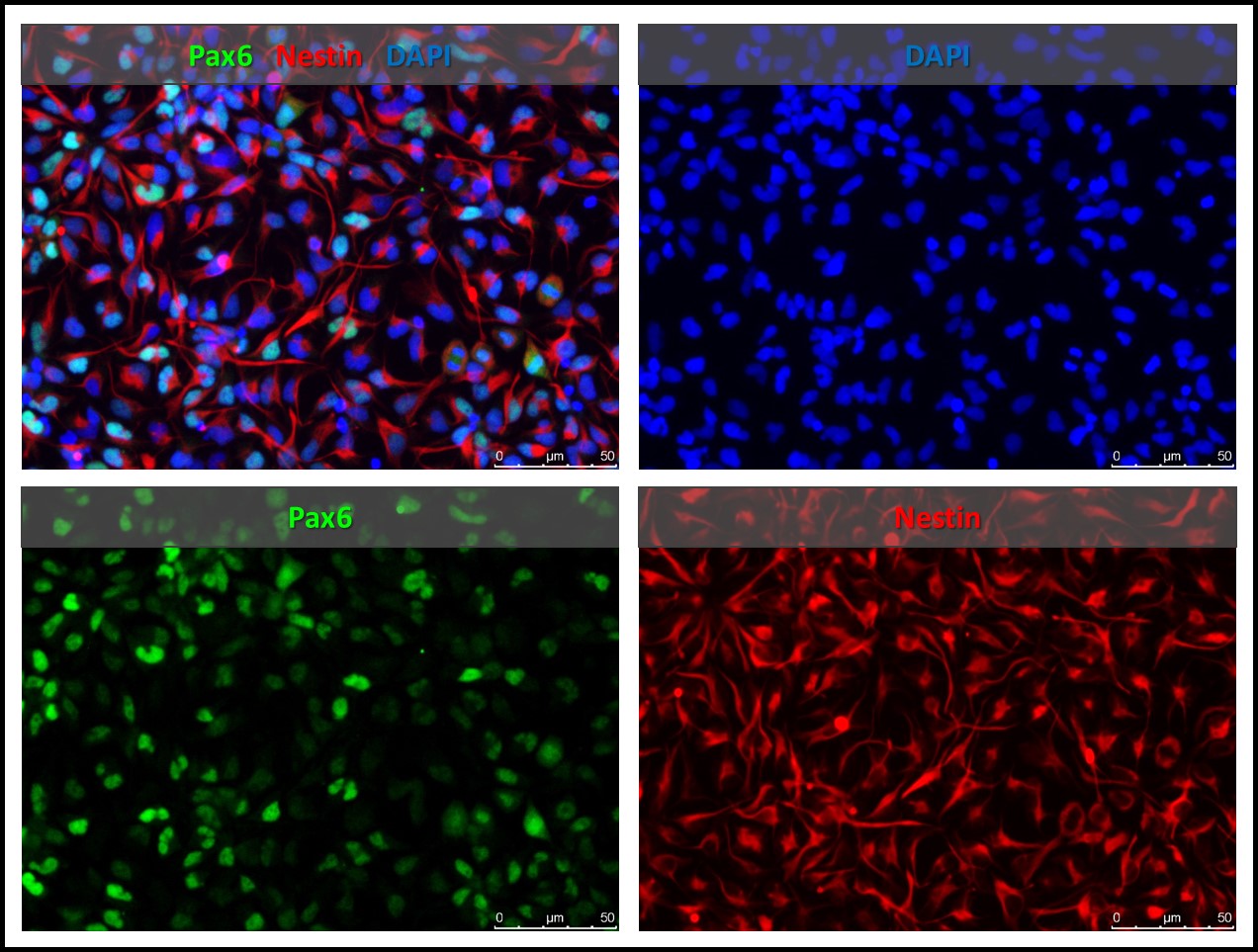 iPSC-derived neural stem cells