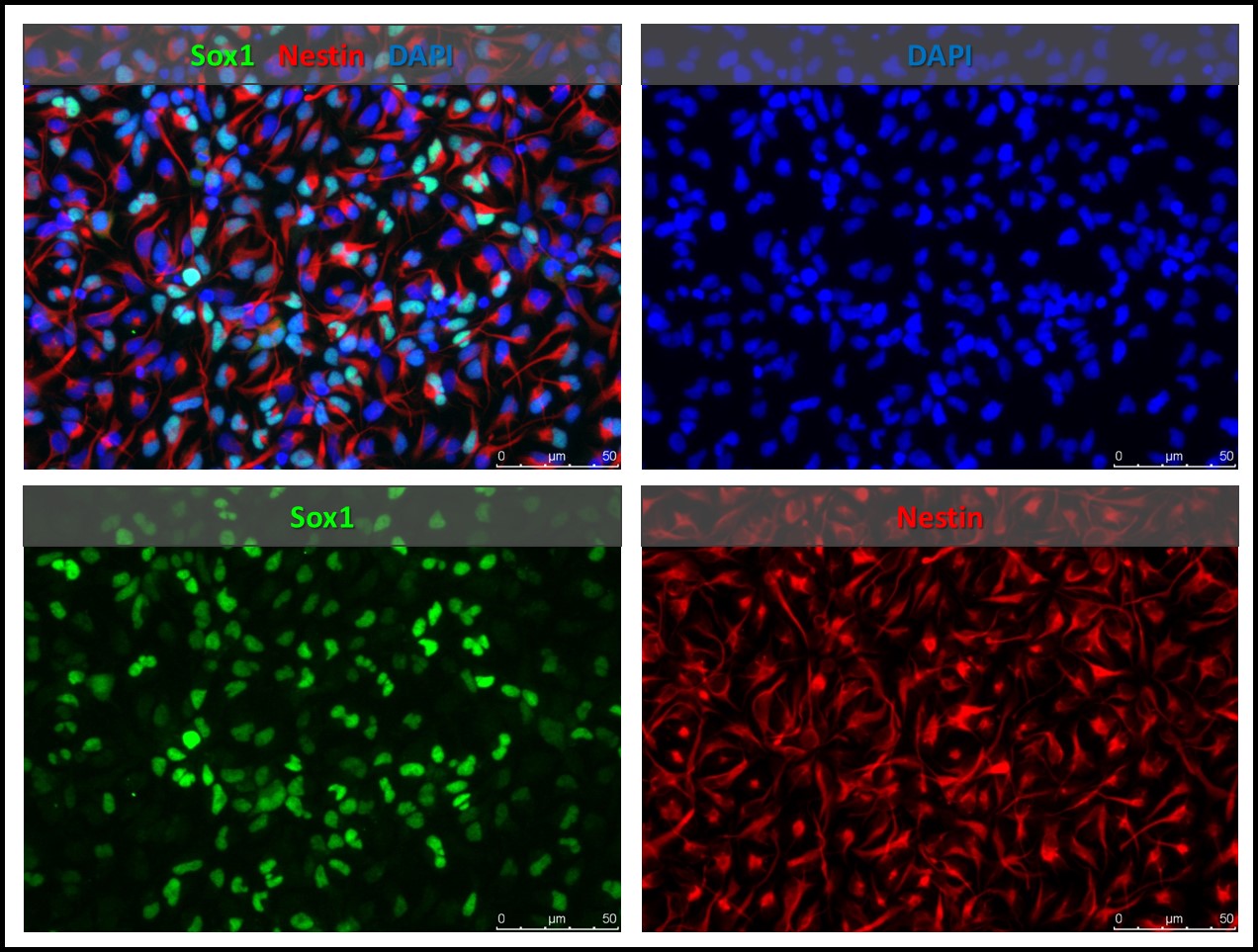 iPSC-derived neural stem cells