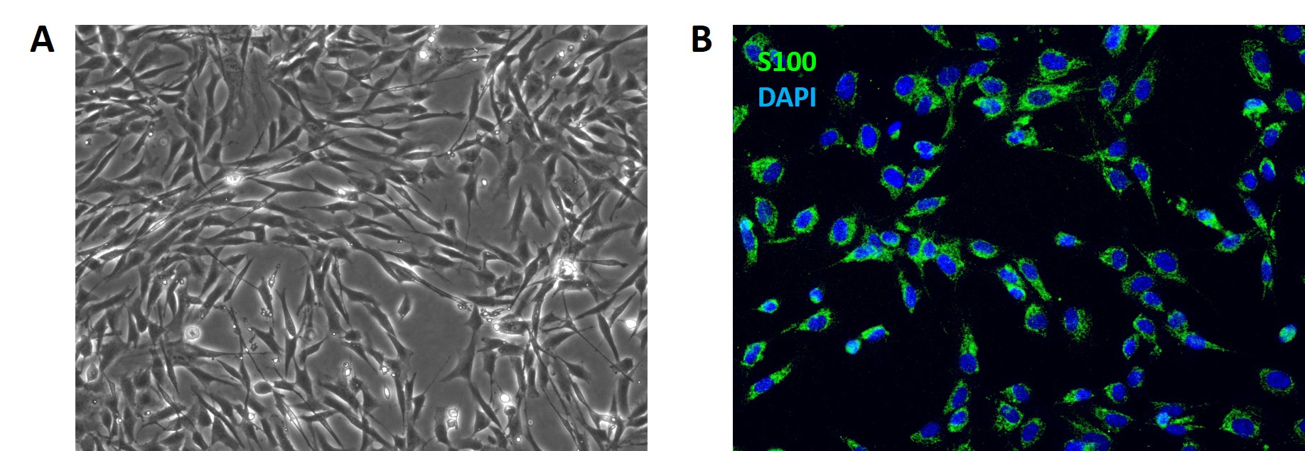 Human Schwann Cells (HSwC)