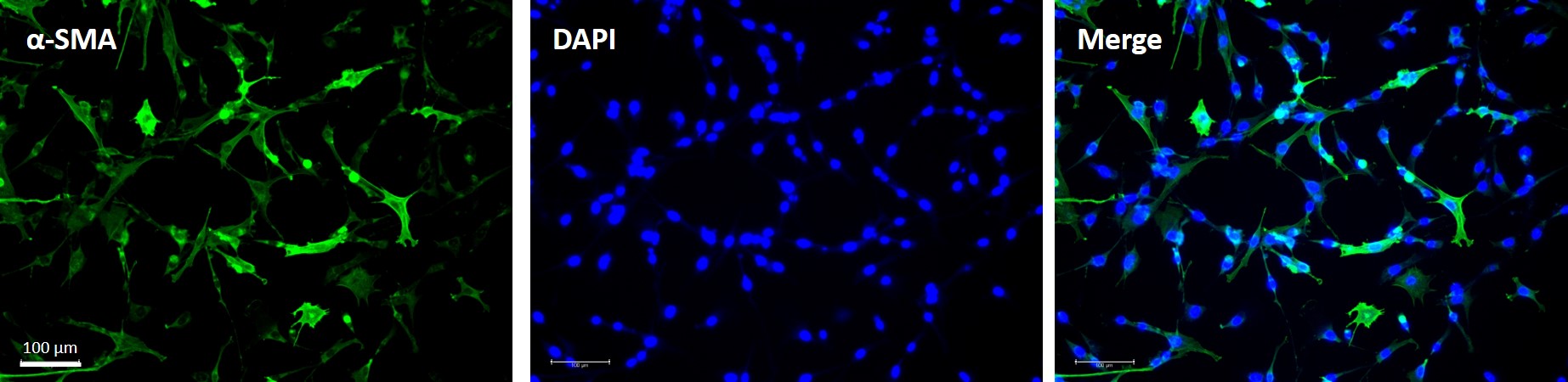 Porcine Pulmonary Artery Smooth Muscle Cells (PPASMC)