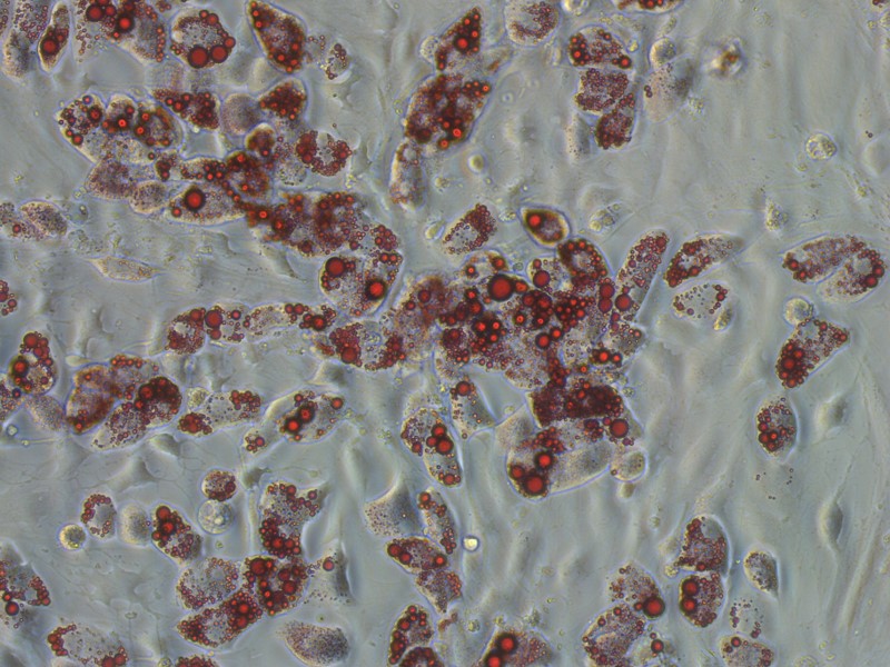 Rat Mesenchymal Stem Cells - Bone Marrow (RMSC-bm)