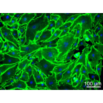 Human Pancreatic Microvascular Endothelial Cells (HPaMEC)