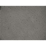 Human Hepatic Stellate Cells - NASH (HHSC -N)