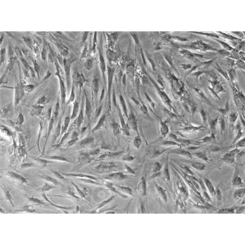 Human Adipose Derived Stem Cells (ADSCs, Type 1 Diabetes)
