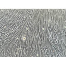 Human Dermal Fibroblasts-neonatal (HDF-n)